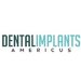 DentalImplantsAmericus