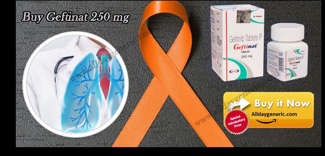43993b8f1f16d16e7c23ce5c5df9c7ed13c38e19.png