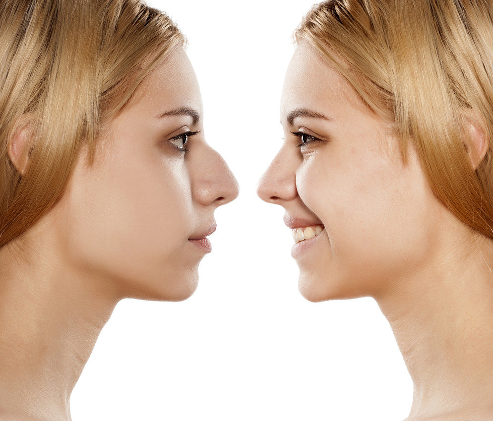 5fa221e37c1b710ac4ae5d85f49db1f1a51718e0.png