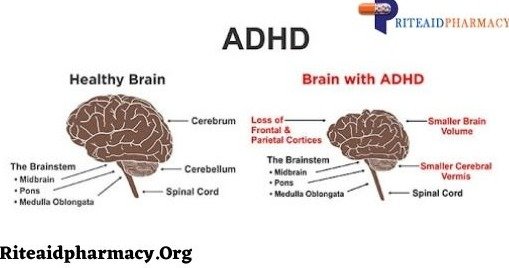 0adf320107bd3c2ac9306af1c1bd585b649428d5.png