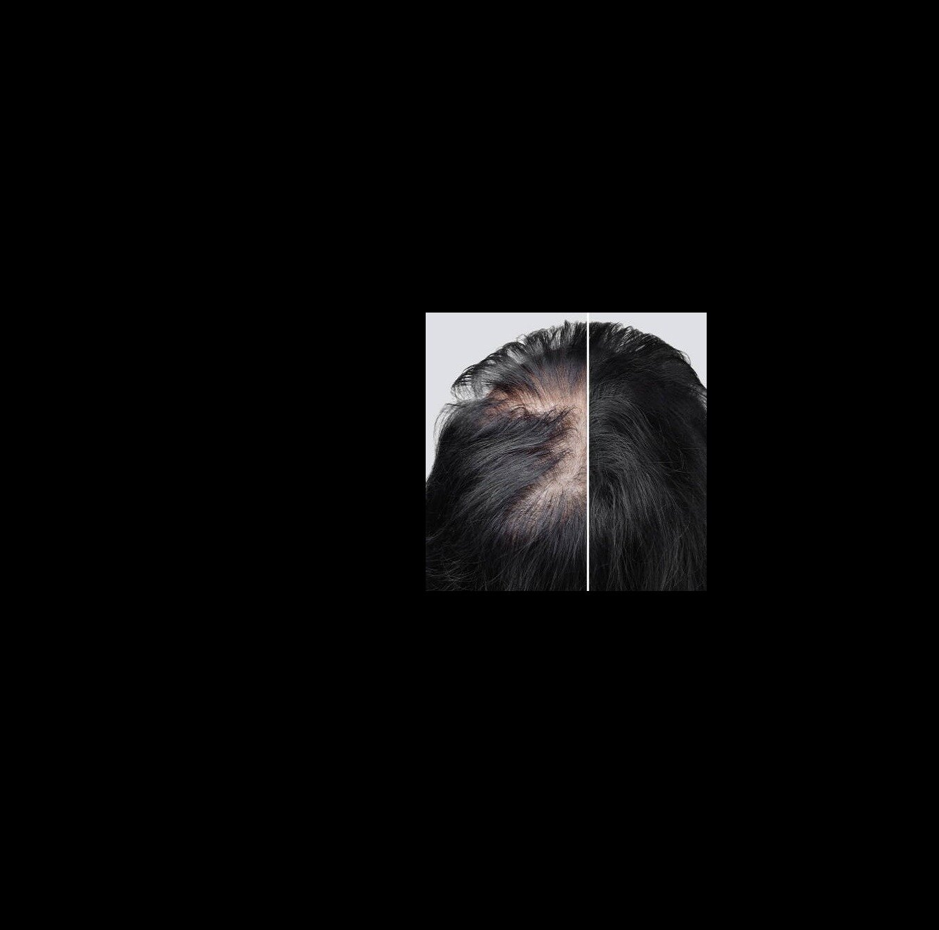 9f877f2cd584c545b626a30864aeb897d0d97cc1.png