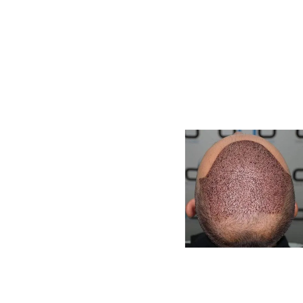 adaf18bb2b6b2e2c9e553993c3707f5f0c112a38.png