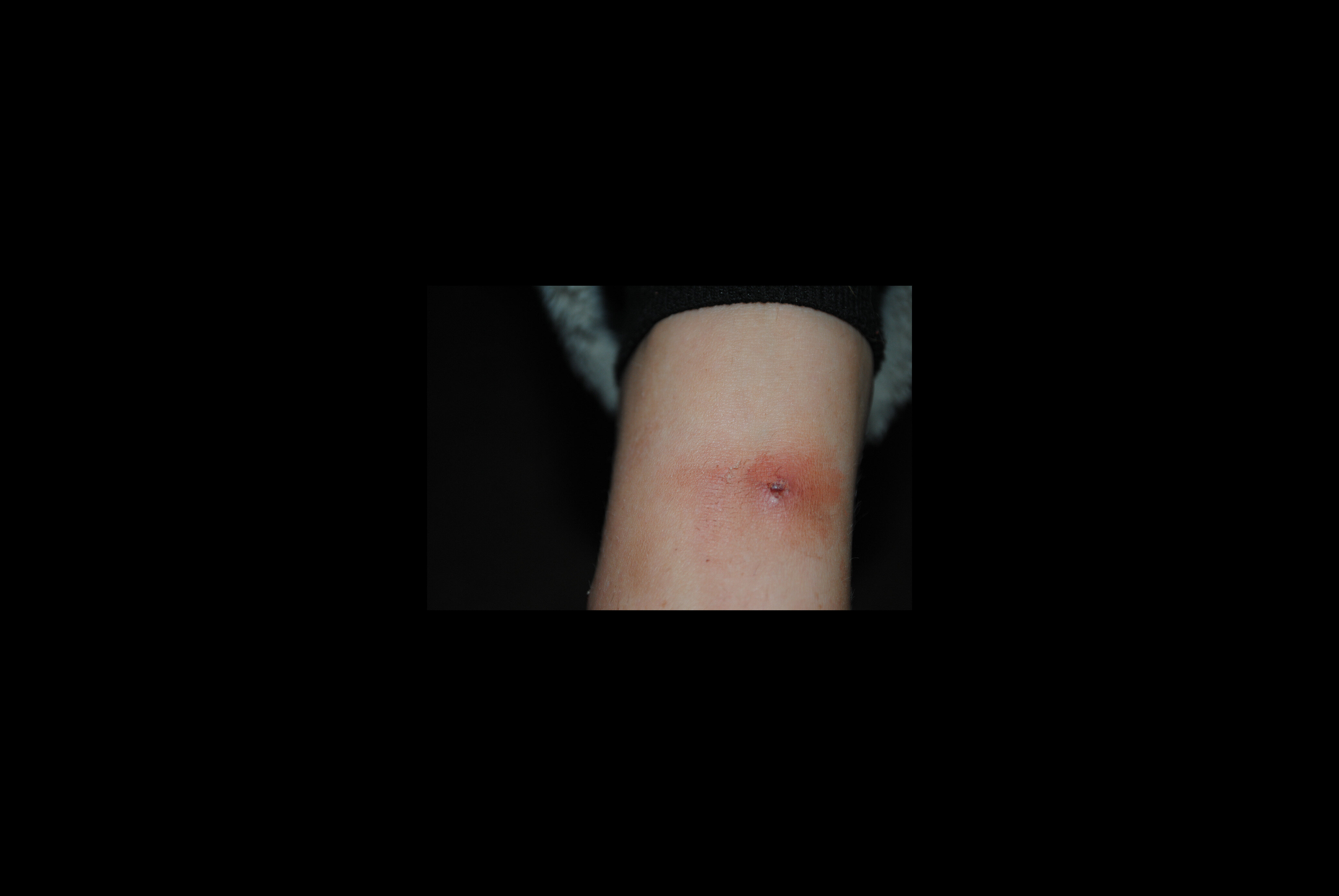 e3e4decdcc372cdd94e7c9f479c742c83061049f.png