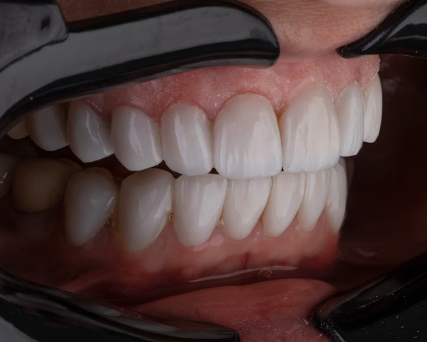 aa571e64149c0dfcda20253a0eda30907b8c3d71.png