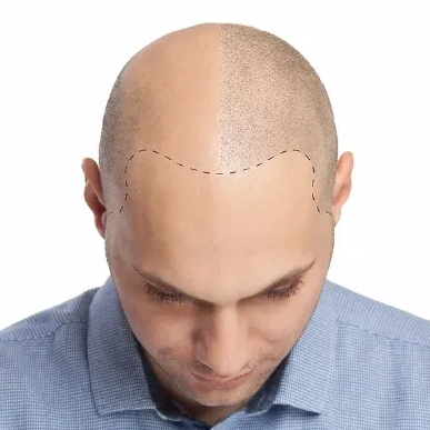 1b26dd3470c17b356e5911e23e48533a7ccd89ba.png